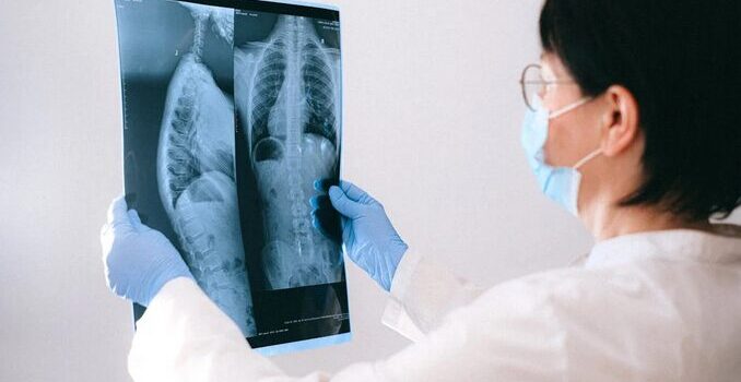 lungs
